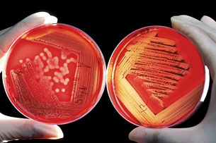 Día Mundial del Microbioma