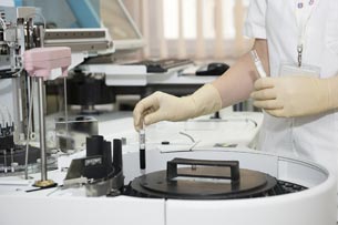 Día Mundial contra la Hepatitis Vírica Día Mundial contra la Hepatitis Vírica